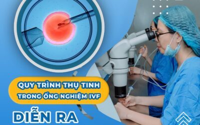 CÁC BƯỚC LÀM IVF  – HÀNH TRÌNH HIỆN THỰC HÓA GIẤC MƠ ĐÓN CON YÊU