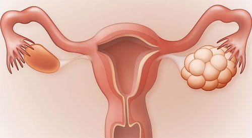 Tổng hợp các kỹ thuật hỗ trợ sinh sản phổ biến cho gia đình Việt