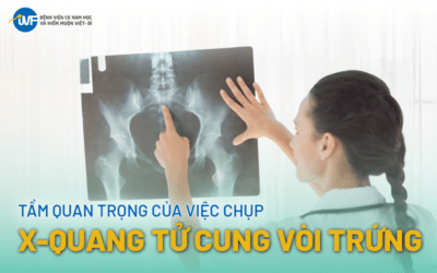 KHÁM HIẾM MUỘN CÓ CẦN NHỊN ĂN KHÔNG? LỜI KHUYÊN TỪ IVF VIỆT – BỈ