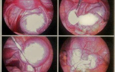 [:vi]Ca tư vấn tình dục nhớ đời của bác sĩ nam khoa[:]