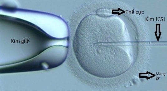 TINH DỊCH ĐỒ – NHỮNG ĐIỀU CẦN BIẾT?