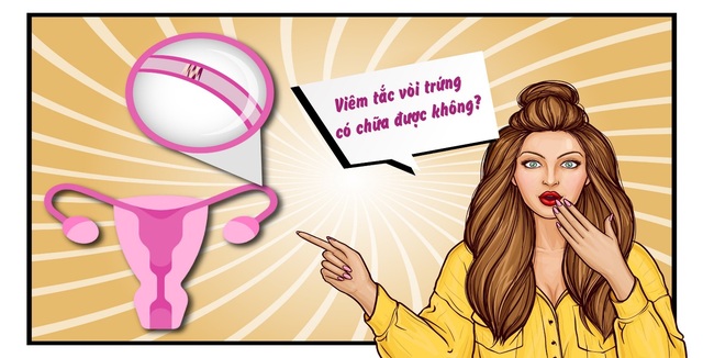 Những bí quyết để giảm thiểu nguy cơ tắc vòi trứng - 2